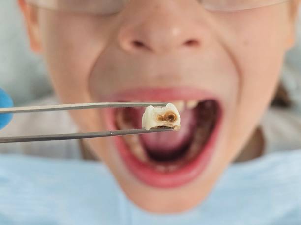 Best Broken or Chipped Tooth Repair in Linganore, MD